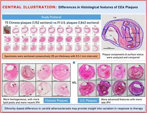 Chinese Neurosurgical Journal study compares carotid plaque composition in patients from China and US